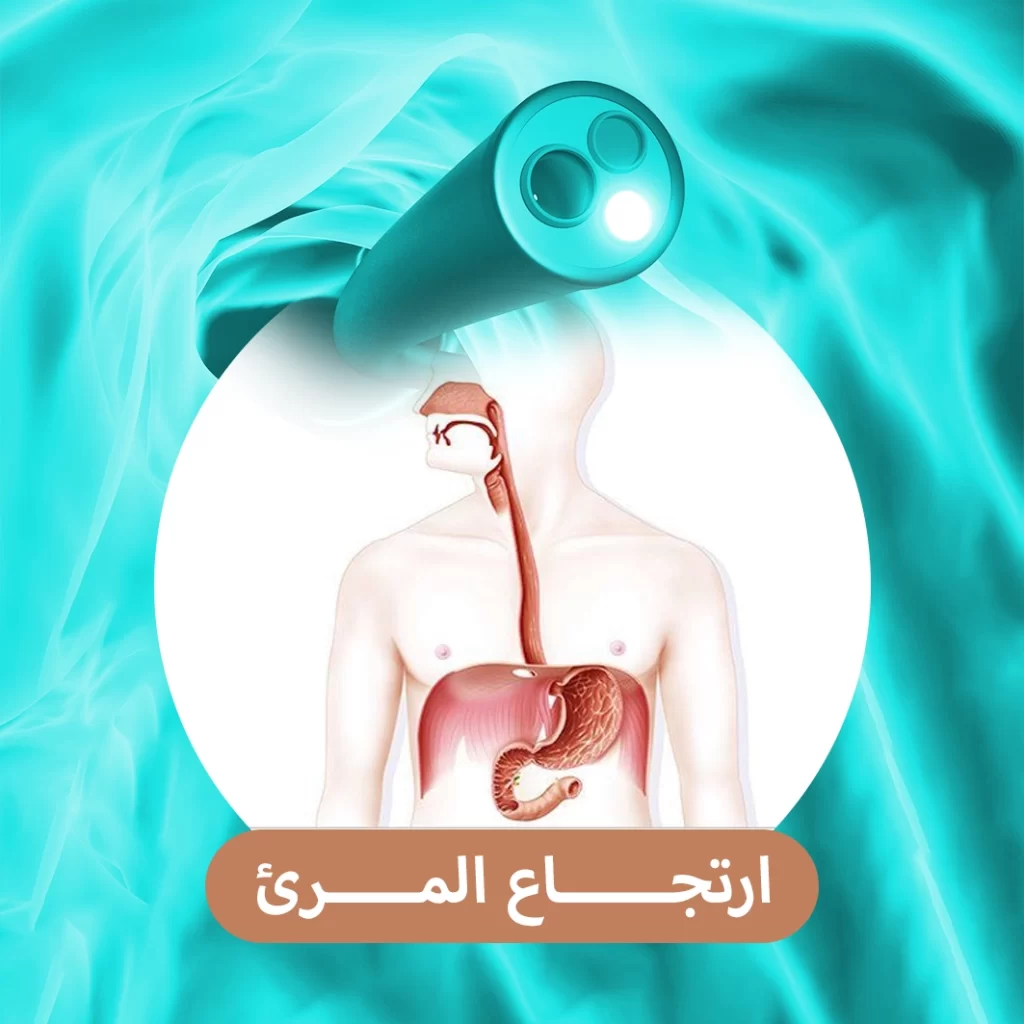 ارتجاع المرئ
