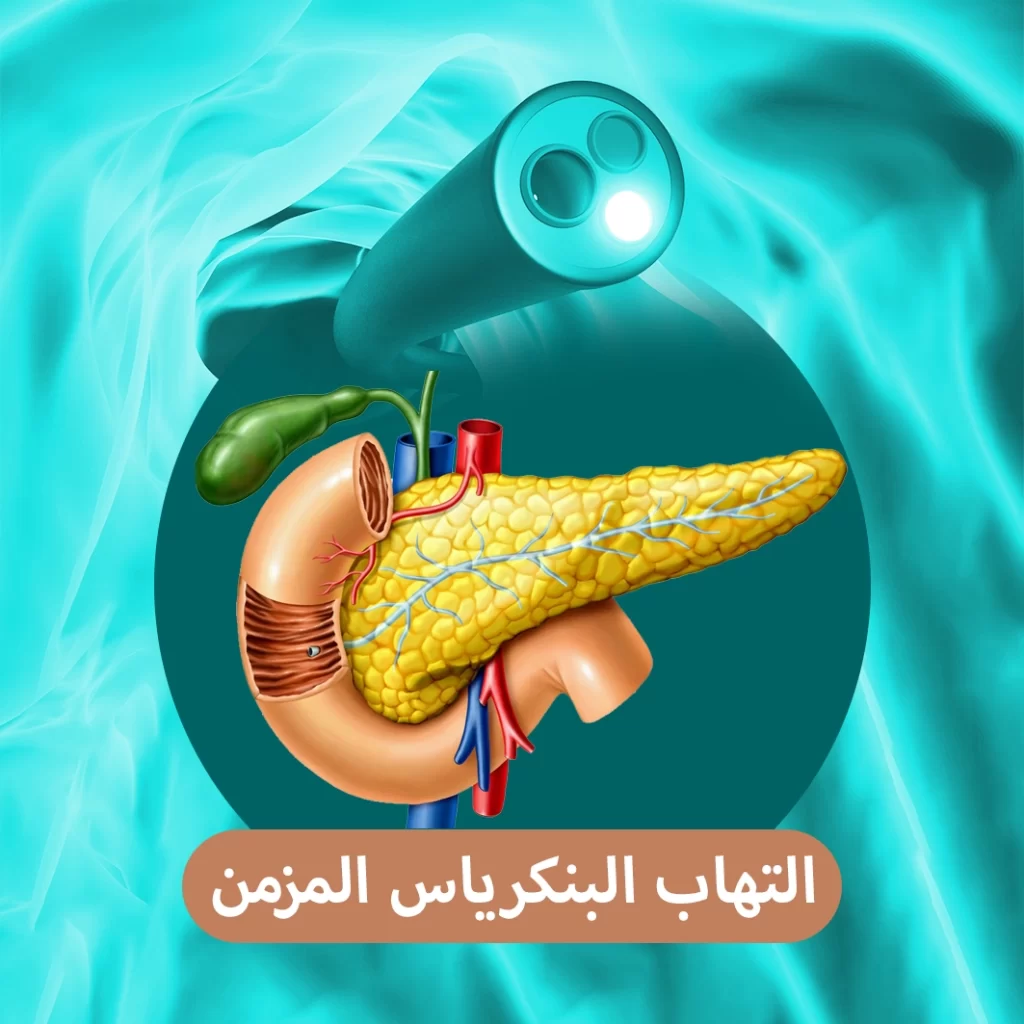 التهاب البنكرياس المزمن