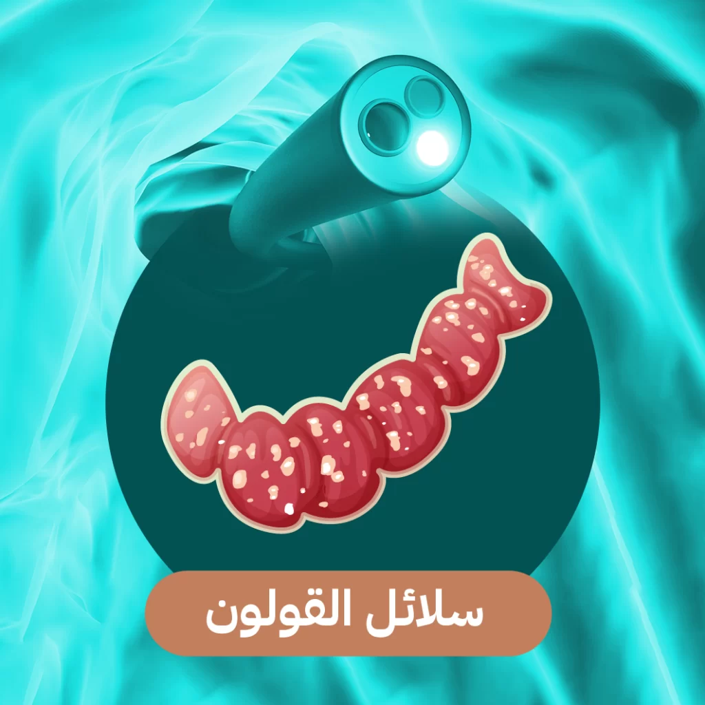 سلائل القولون