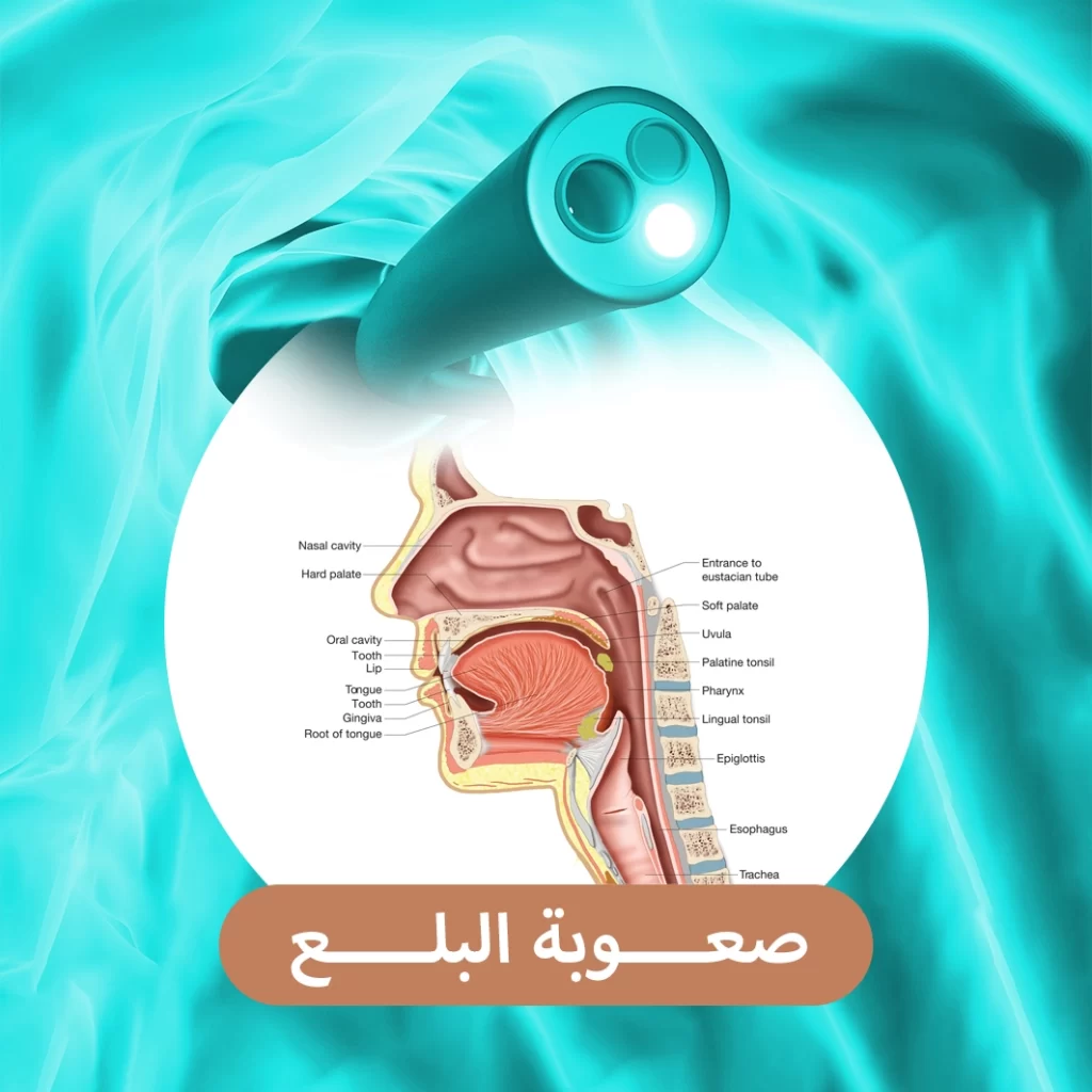 صعوبة البلع
