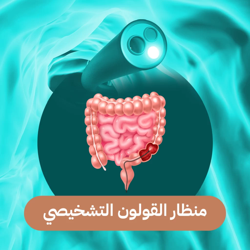 منظار القولون التشخيصي