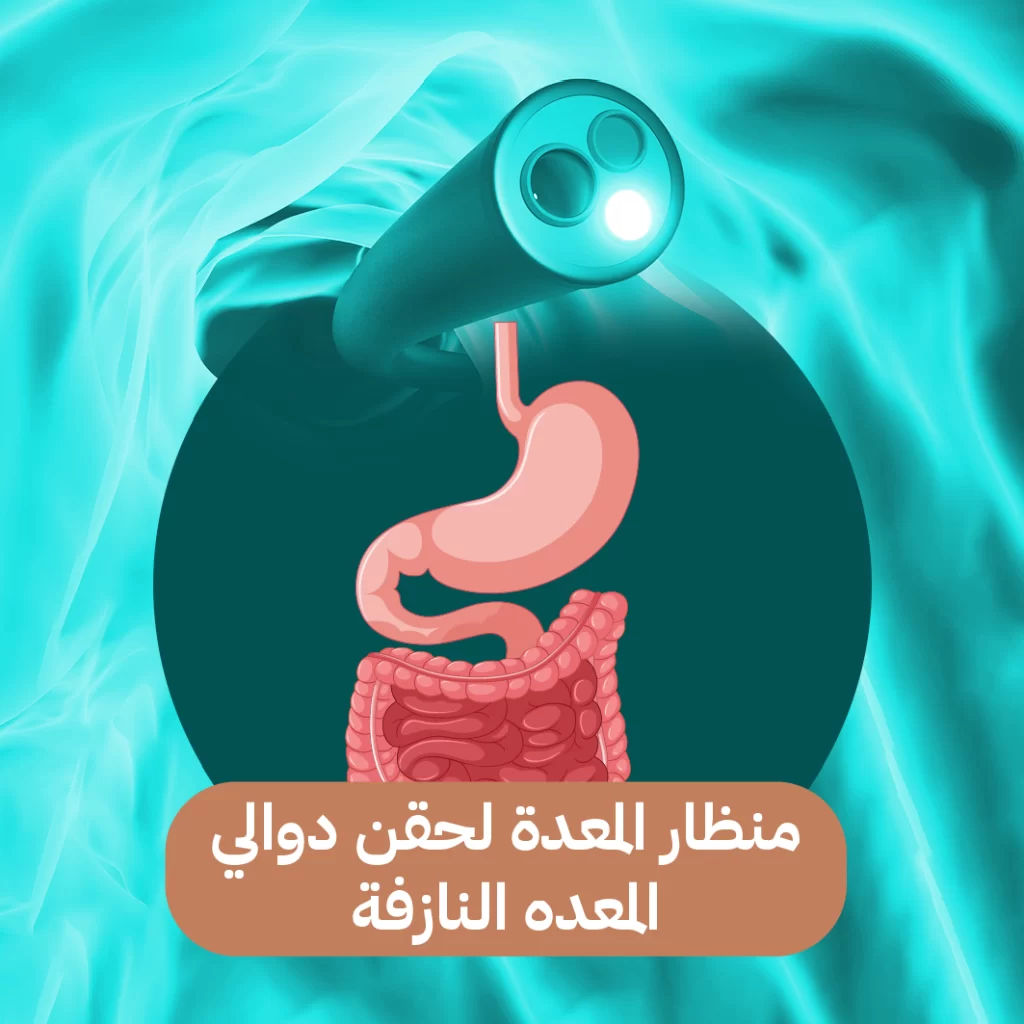 منظار المعدة لحقن دوالي المعدة