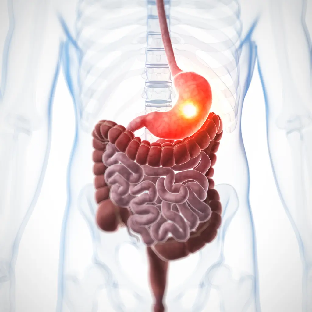 علاج جرثومة المعدة نهائيا بالمنظار - Dr. Mohamed Alboraie, image size:1024x1024