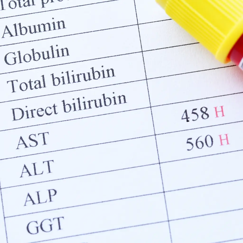 متى نقلق من ارتفاع إنزيم الكبد alt