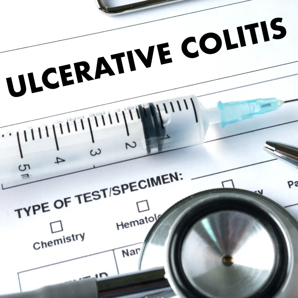 علاج تقرحات القولون