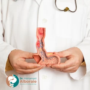 علاج ارتخاء العضلة العاصرة للمريء