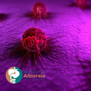 أعراض سرطان المريء الحميد