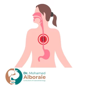 تجربتي مع سرطان المريء