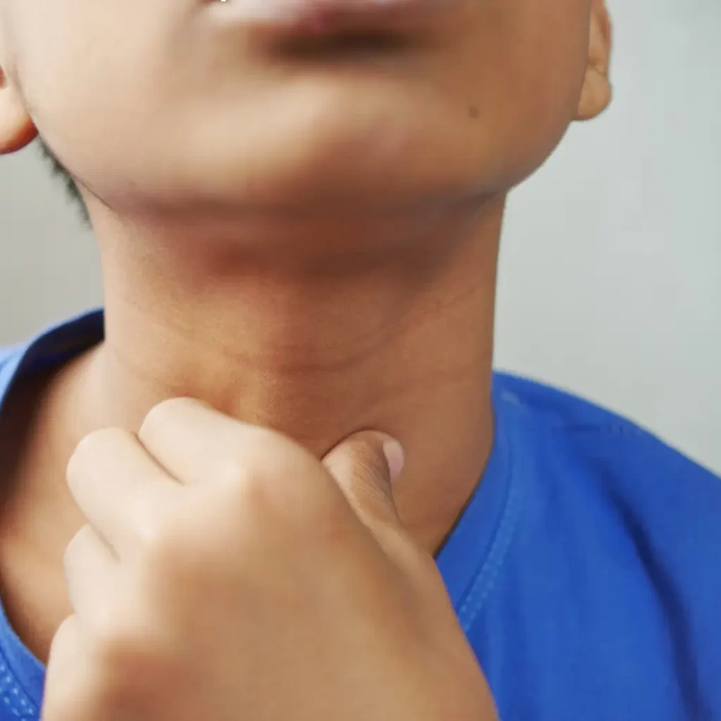 كم يعيش مريض سرطان المريء