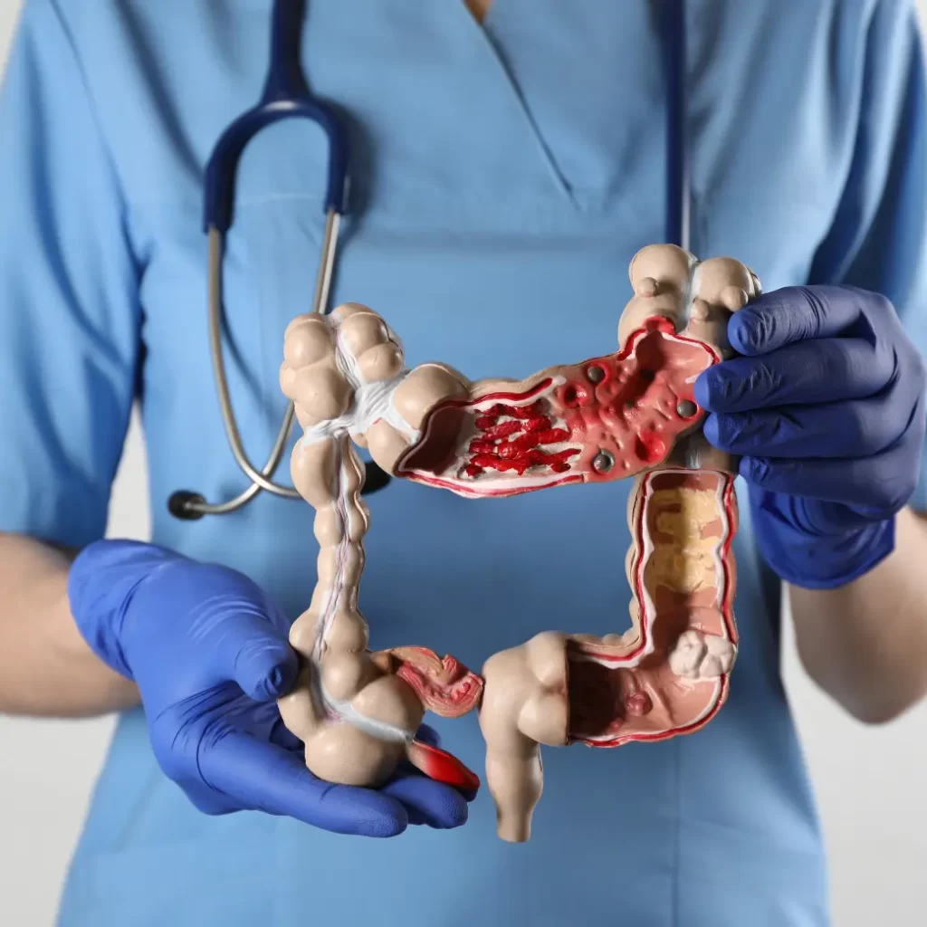 دكتور قولون ومستقيم