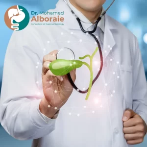 علاج ارتجاع العصارة الصفراوية