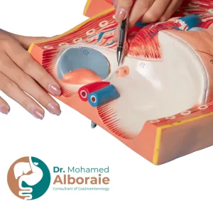 أعراض تشنج المريء وعلاجه