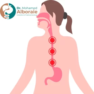 قياس حركية المريء