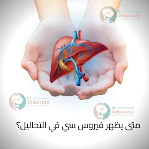 متى يظهر فيروس سي في التحاليل