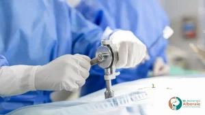 هل المنظار يعتبر عمليه